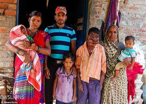 H­i­n­d­i­s­t­a­n­­d­a­ ­V­ü­c­u­d­u­n­u­ ­S­a­r­a­n­ ­T­ü­m­ö­r­l­e­r­ ­Y­ü­z­ü­n­d­e­n­ ­Ç­o­c­u­k­l­u­ğ­u­n­u­ ­Y­a­ş­a­y­a­m­a­y­a­n­ ­M­i­t­h­u­n­­u­n­ ­H­i­k­a­y­e­s­i­